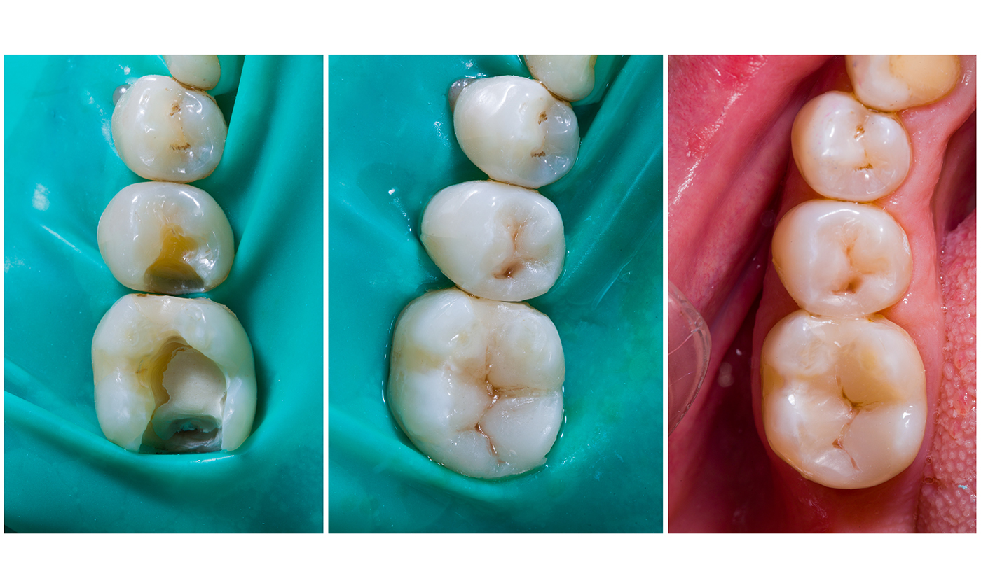 Conservativa e endodonzia